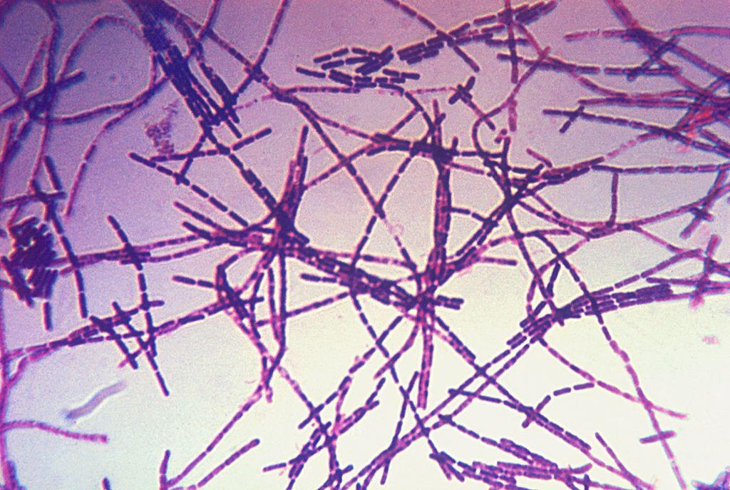 Бактерията Bacillus anthracis, която причинява заболяването антракс. Снимка: