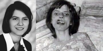 Anneliese Michele before and after. A healthy and young woman vs. close to death